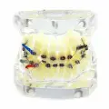 Челюсть стоматологическая, модель челюсти с металлическими брекетами, прозрачная