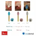Incidental Трехступенчатая система OCCLUFLEX , Полировка, Предварительная, до зеркального блеска, композитных и гибридных керамических 3шт